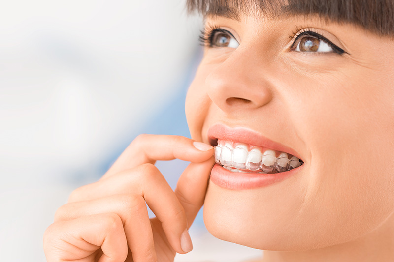 Orthodontics in Moscow