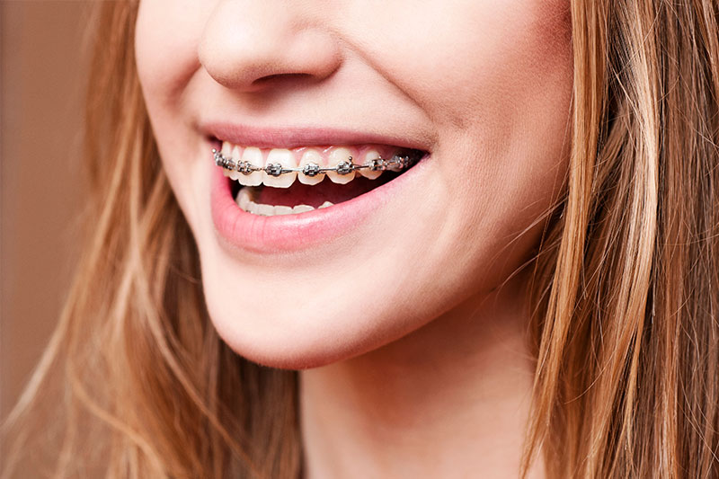 Orthodontics in Moscow